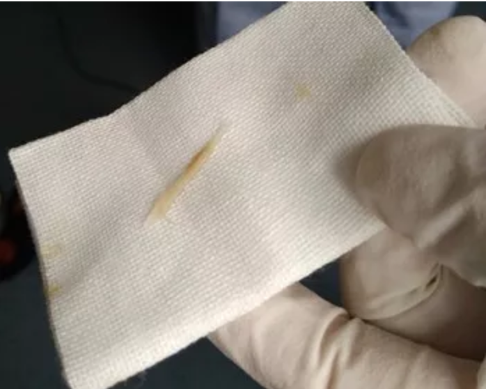 一条鱼刺惹的祸……