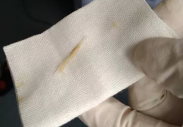 一条鱼刺惹的祸……