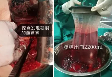 小伙子只是弯腰开电脑，差点把命都搭上了！