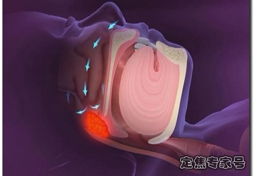打呼噜？莫让小孩交上这个“坏朋友”！
