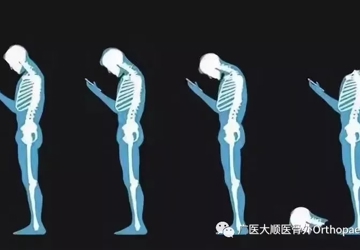 【科普】美女，你的“绝味鸭脖”掉啦，医生喊你呢！