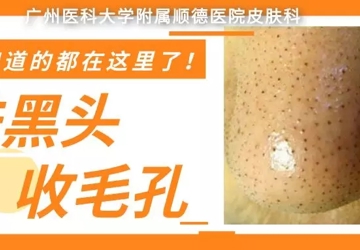 【科普】祛黑头，收毛孔？你想知道的，都在这里了！