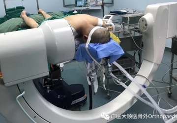 上帝关上一扇窗的同时会打开一扇门——无骨折脱位型颈髓损伤