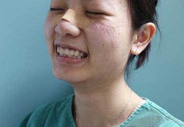 这痕迹真美！是天使的印记，是最美的勋章！