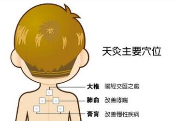 疫情防控强体质，三伏天灸安排上，今年还有儿童专场哦