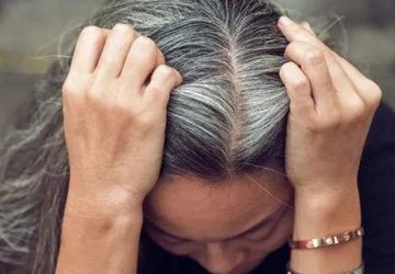 年纪轻轻却白发苍苍，还真是愁出来的？