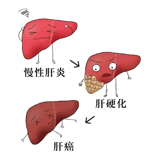全国爱肝日丨来点“肝”货→