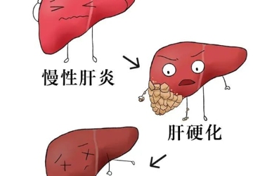 全国爱肝日丨来点“肝”货→